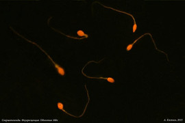 Chồng phát hiện vô sinh sau khi cưới vợ 35 năm, có 9 người con