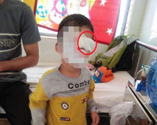 Bé trai bị bạn bắn bút chì trúng mắt: Phòng GD-ĐT sẽ xử lý nghiêm giáo viên