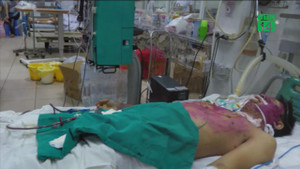 Tự ý uống thuốc chữa thủy đậu, người đàn ông suy nội tạng nguy kịch