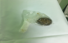 Miếng nấm đông cô tắc ở chỗ hiểm, hành hạ nam thanh niên ở Sài Gòn