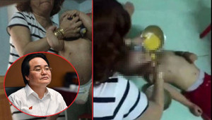 Cô giáo bóp mặt, tát trẻ, Bộ trưởng GD&ĐT: 'Hành động rất đáng phê phán, không sư phạm, vô nhân tính'