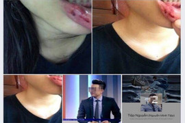 Nữ sinh trường Amsterdam tố BTV Minh Tiệp bạo hành: Cục Bảo vệ và Chăm sóc trẻ em lên tiếng