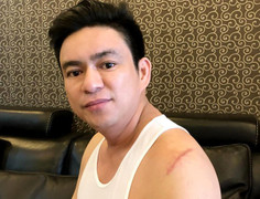 Bắt vợ cũ nghi là chủ mưu vụ chém bác sĩ Chiêm Quốc Thái