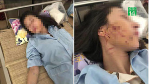 Cô gái bị lột quần áo, đổ nước mắm, xát ớt vào người: Nạn nhân nói gì?