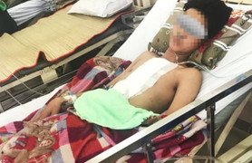 Báo động đỏ liên viện cứu bệnh nhân bị đâm thủng tim, phổi nguy kịch