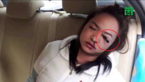 Vừa đi taxi vừa trang điểm, bị kẻ chì đâm vào mắt