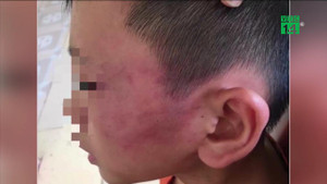 Cô giáo tiểu học tát con riêng của chồng nhập viện lên tiếng trần tình