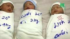 Bỏ điều trị vô sinh, cô gái 25 tuổi bất ngờ sinh ba