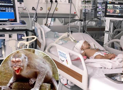 Bé gái 14 tháng tuổi ở TP.HCM bị khỉ nhà hàng xóm cắn chấn thương nặng