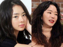 Lạm dụng dao kéo, loạt sao thế giới ngày càng khó nhận ra