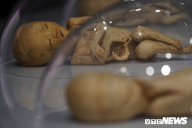 Lãnh đạo thuộc Bộ Văn hóa đích thân vào kiểm tra triển lãm mô hình nội tạng và cơ thể người