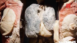 Triển lãm mô hình xác người, thai nhi ở TP.HCM: Dư luận phản ứng thế nào?