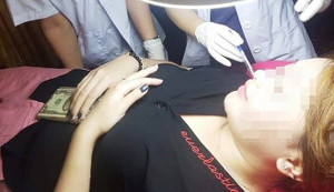 Tiêm filler nâng mũi, một phụ nữ đối diện với bi kịch mù mắt