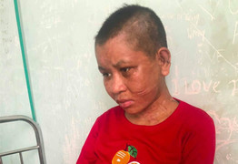 Người làm thuê tố bị chủ nhà dùng kìm bẻ răng và dao lam rạch mặt