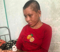 Video: Lời kể nhói lòng của người làm thuê tố bị chủ nhà dùng kìm bẻ răng, dao lam rạch mặt