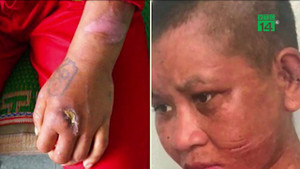 Người làm thuê tố bị chủ bẻ răng, cắt tai như thời trung cổ: Chủ có biểu hiện ngáo đá