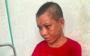 Người làm thuê tố bị chủ bẻ răng, cắt tai như thời trung cổ: Tin mới nhất