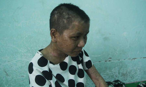 Nữ giúp việc bị chủ tra tấn man rợ như thời trung cổ sẽ được phẫu thuật thẩm mỹ miễn phí