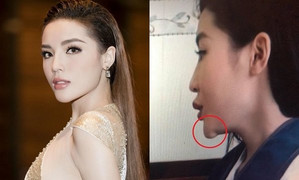 Phủ nhận ‘dao kéo’ gương mặt nhưng Kỳ Duyên lại để lộ chiếc cằm dị dạng ở góc nghiêng