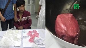 Tội phạm giấu bọc ma túy khủng trong vùng kín, bác sỹ mất 12 tiếng để lấy ra