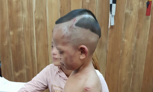 Khởi tố gã cha dượng đánh đập dã man bé trai 3 tuổi ở Phú Quốc