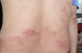 Người trả lời phỏng vấn trong phóng sự điều tra của VTV9 bị hành hung