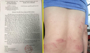 Giám đốc, nhân viên VTV9 bị doanh nghiệp dọa truy sát: Hội Nhà báo Việt Nam lên tiếng