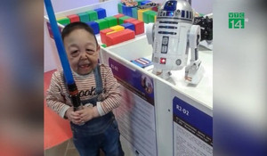 Cậu bé 6 tuổi da nhăn nheo, chảy xệ như ông già 60