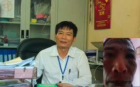 Sự thật dân tố bị công an xã bắt vô cớ, đánh đập dã man