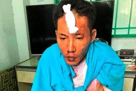 Bị vợ đuổi khỏi nhà, chồng tức giận dùng xăng thiêu cháy 3 mẹ con