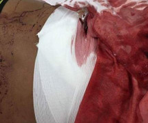 Ngư phủ Kiên Giang đâm chết đồng nghiệp trên bàn nhậu