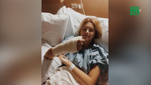 Mắc ung thư da hiếm gặp chỉ vì tật cắn móng tay