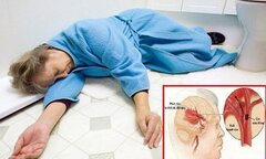 Khống chế tử thần đột quỵ não chỉ với 1 phút mỗi ngày