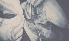 Nam thanh niên bị đâm thấu tim, sốc mất máu nặng được cứu