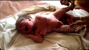Clip: Em bé ra đời với 4 chân gây kinh ngạc