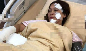 Cháy phim trường, nữ diễn viên 'Anh hùng xạ điêu' bỏng nặng