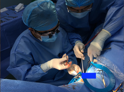 Dây câu cá nằm trong 'cậu nhỏ' suốt 11 năm, nam thanh niên gặp họa