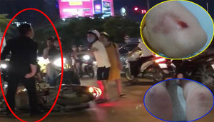 Sau va chạm giao thông, nam thanh niên cao lớn xông vào đánh phụ nữ mang thai 8 tháng