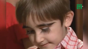 Kỳ lạ cậu bé có hàng lông mi cong vút dài 4,3 cm