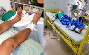 Nam thanh niên bị nhóm côn đồ lái xe tông trực diện, đâm chém giữa phố