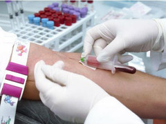 Ống xét nghiệm máu của bệnh nhân hơn một nửa là mỡ