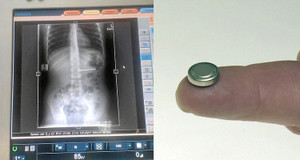 Ép bạn nuốt kim và cảnh báo nguy cơ từ bạo lực học đường