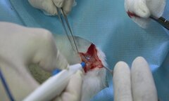 Kĩ sư Việt chế tạo thành công dao mổ cầm máu với chi phí 320 triệu