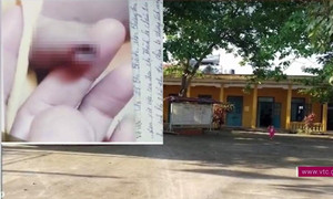 Phụ huynh tố cô giáo đánh chảy máu vùng kín bé trai 3 tuổi: Hiệu trưởng trường mầm non nói gì?