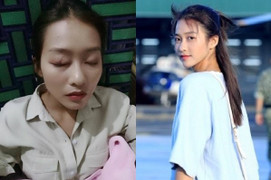 Sức khỏe Khả Ngân sau 2 ngày điều trị dị ứng thuốc