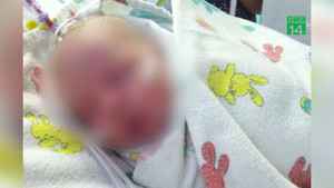 Con 1 tuổi khóc mãi không nín, bố tàn nhẫn đổ keo siêu dính vào miệng, mắt con