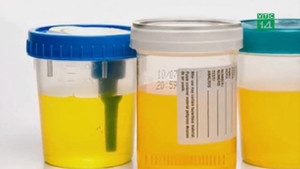 Nở rộ dịch vụ bán nước tiểu cho hàng xóm, bạn bè