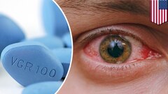 Video: Dùng Viagra quá liều, quý ông trả giá đắt