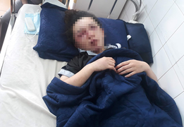 4 nghi can đánh nữ nhân viên Spa ở Gia Lai nhập viện bị triệu tập