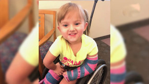 Bị bệnh hiếm, bé gái 5 tuổi bị gãy xương gần 100 lần